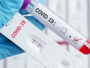 549 са новите случаи на коронавируса у нас сочат данните